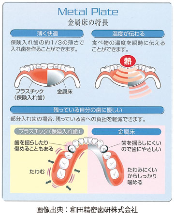 スマートデンチャー　イメージ2